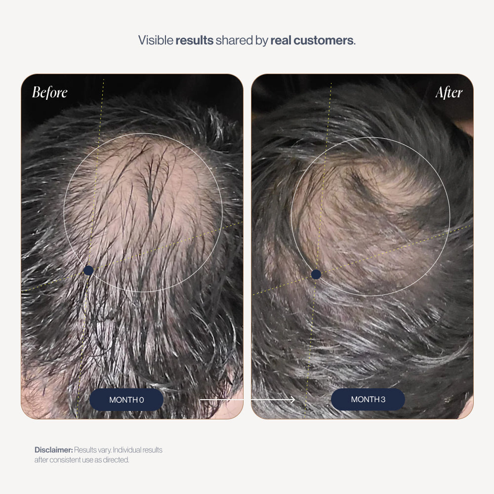 abtest-new VitaFoam before and after results (men)