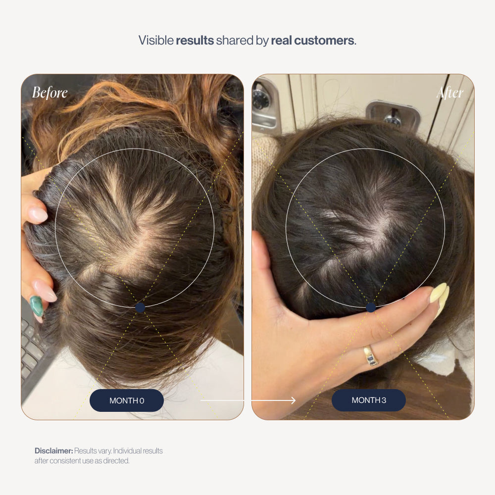 abtest-new Complex10 before and after results (women)