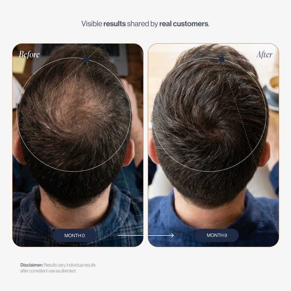 The 3X Growth Kit before and after results (2)