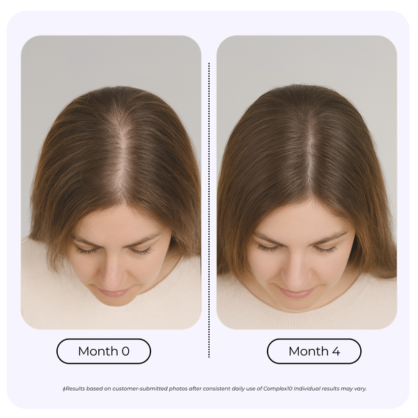 Complex10™ Hair Growth Supplement