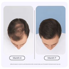 Complex10™ Hair Growth Supplement