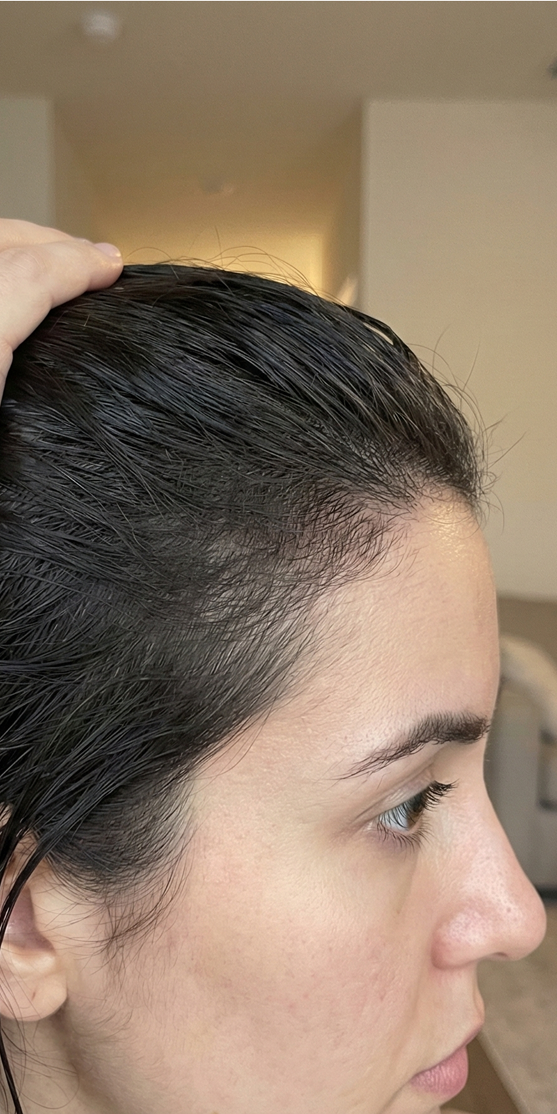 Priscilla G. after