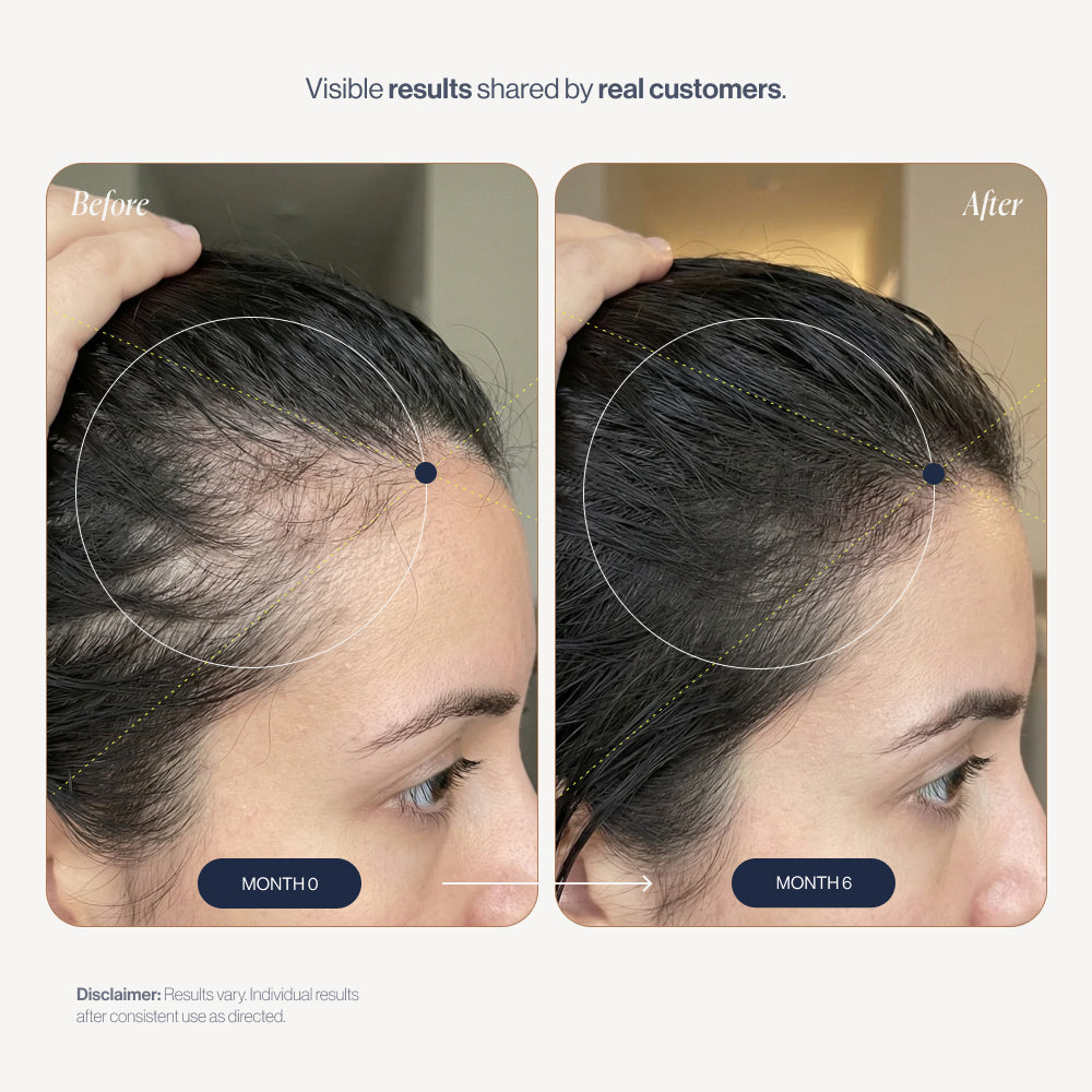 abtest-new VitaFoam before and after results (women)