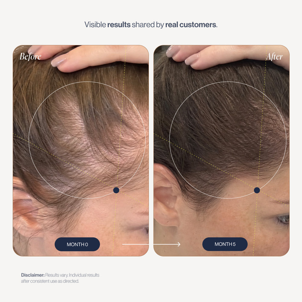 Revive before and after results (women)