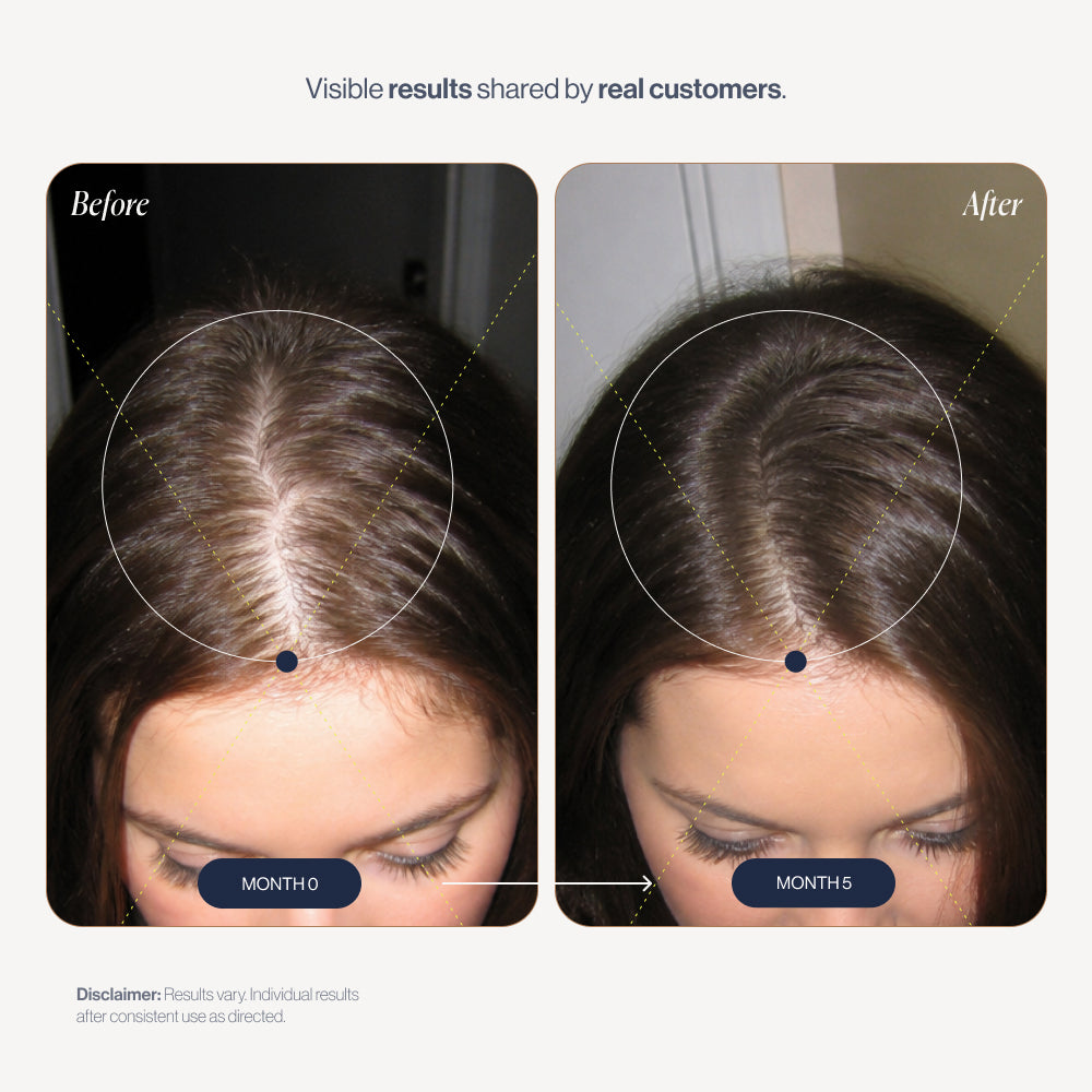 Rosemary Elixir before and after results (women)