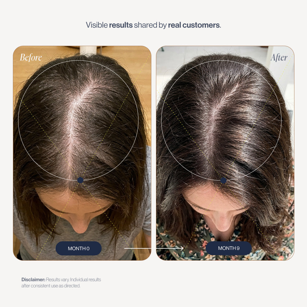 100% Natural Growth Duo before and after results