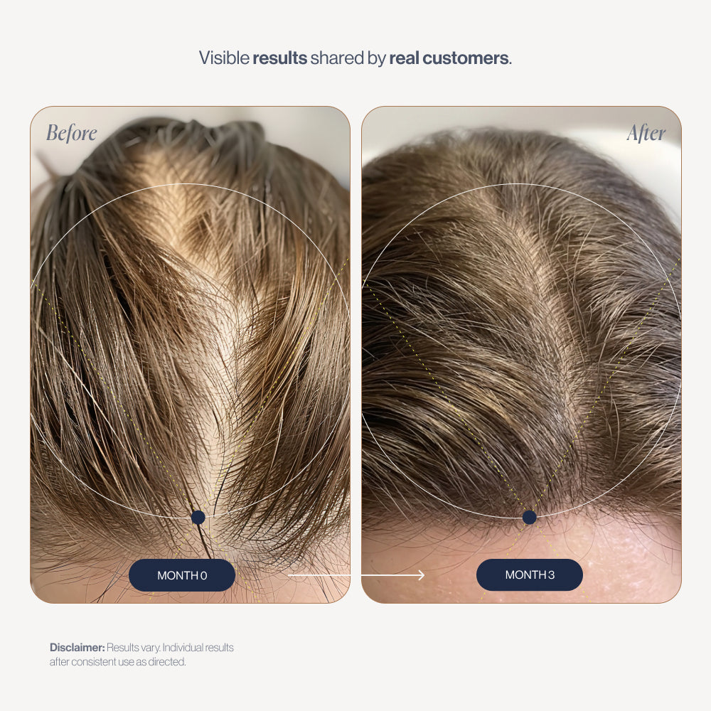 The 3X Growth Kit before and after results