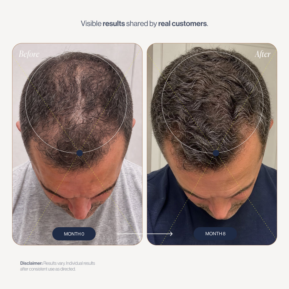 abtest-new Complex10 before and after results (men)