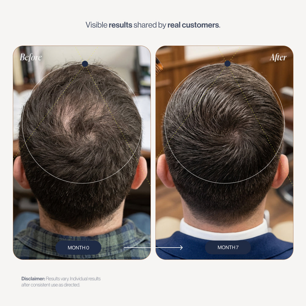 100% Natural Growth Duo before and after results (2)
