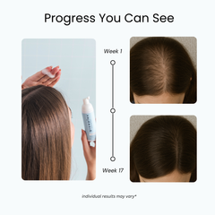 The 3X Growth Kit™