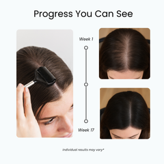Scalp Roller 2.0 + Sanitizer