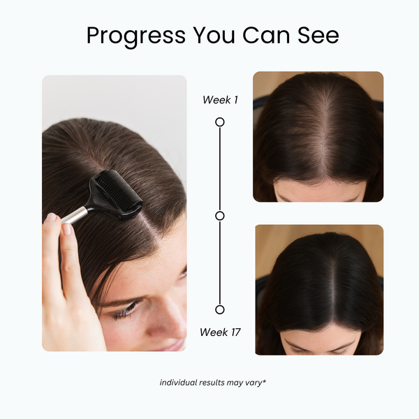 Scalp Roller 2.0 + Sanitizer