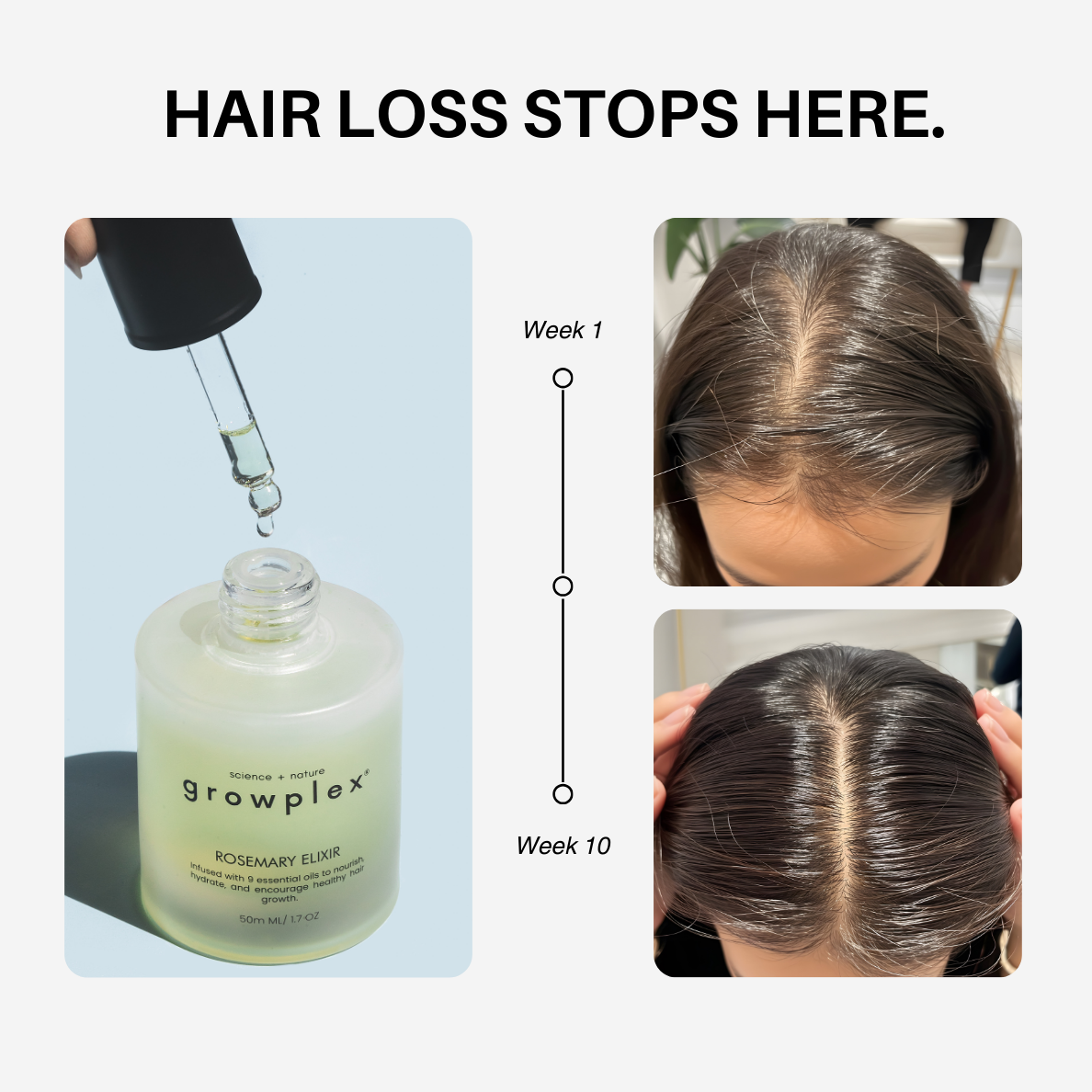 Rosemary Elixir - 100% Natural Hair Loss Solution