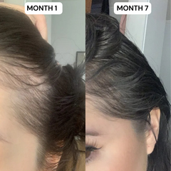 Hair Growth Kit