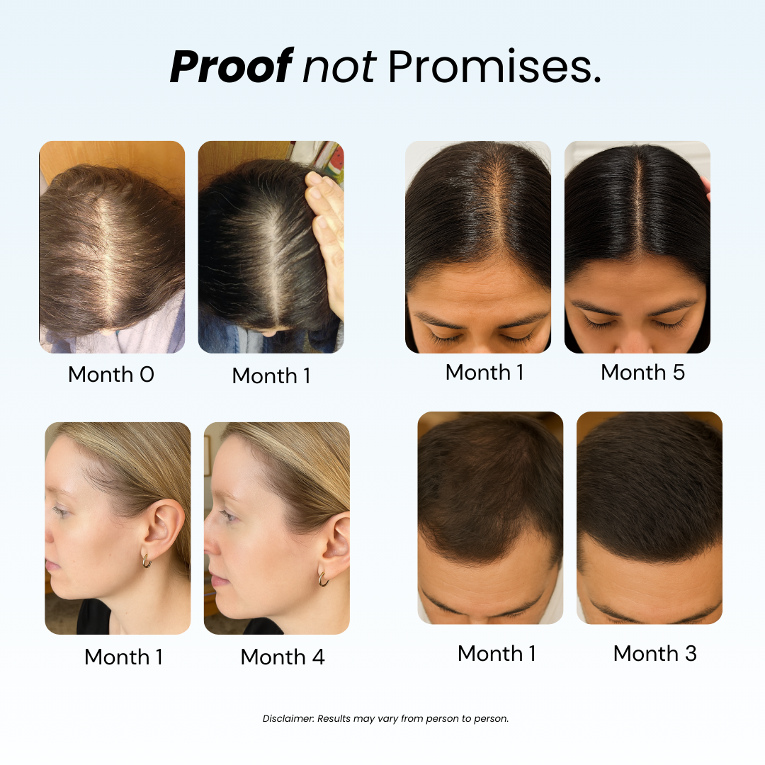 Revive™ Hair Growth Shampoo – Strengthen & Nourish