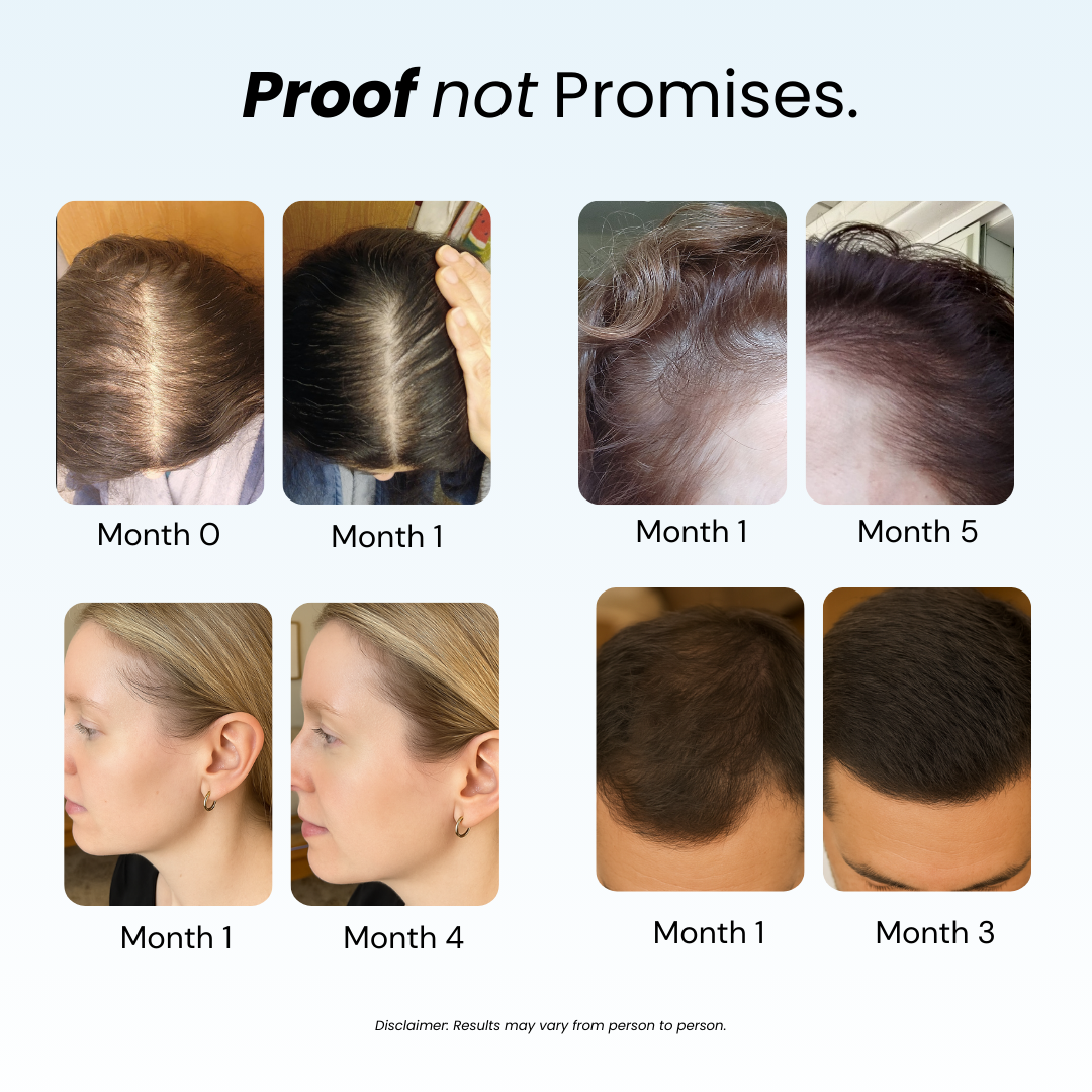 Replenish™ Conditioner – Hydrate & Grow