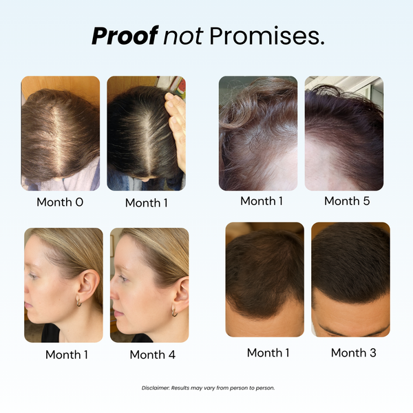 Replenish™ Conditioner – Hydrate & Grow