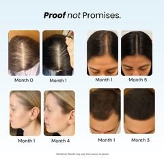 Revive™ & Replenish™ - Hair Growth Shampoo and Conditioner