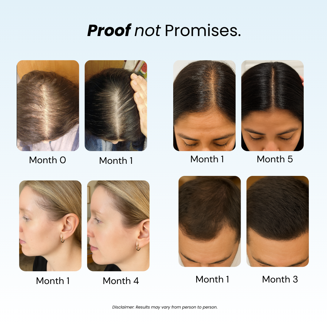 Revive™ & Replenish™ - Hair Growth Shampoo and Conditioner