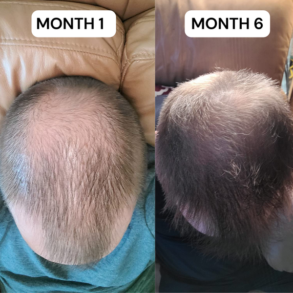 VITAFOAM ™ Hair Growth Formula