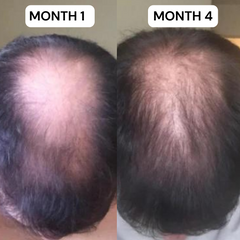 VITAFOAM ™ Hair Growth Formula