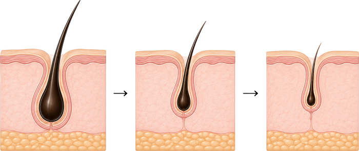 What Happens to hair follicles