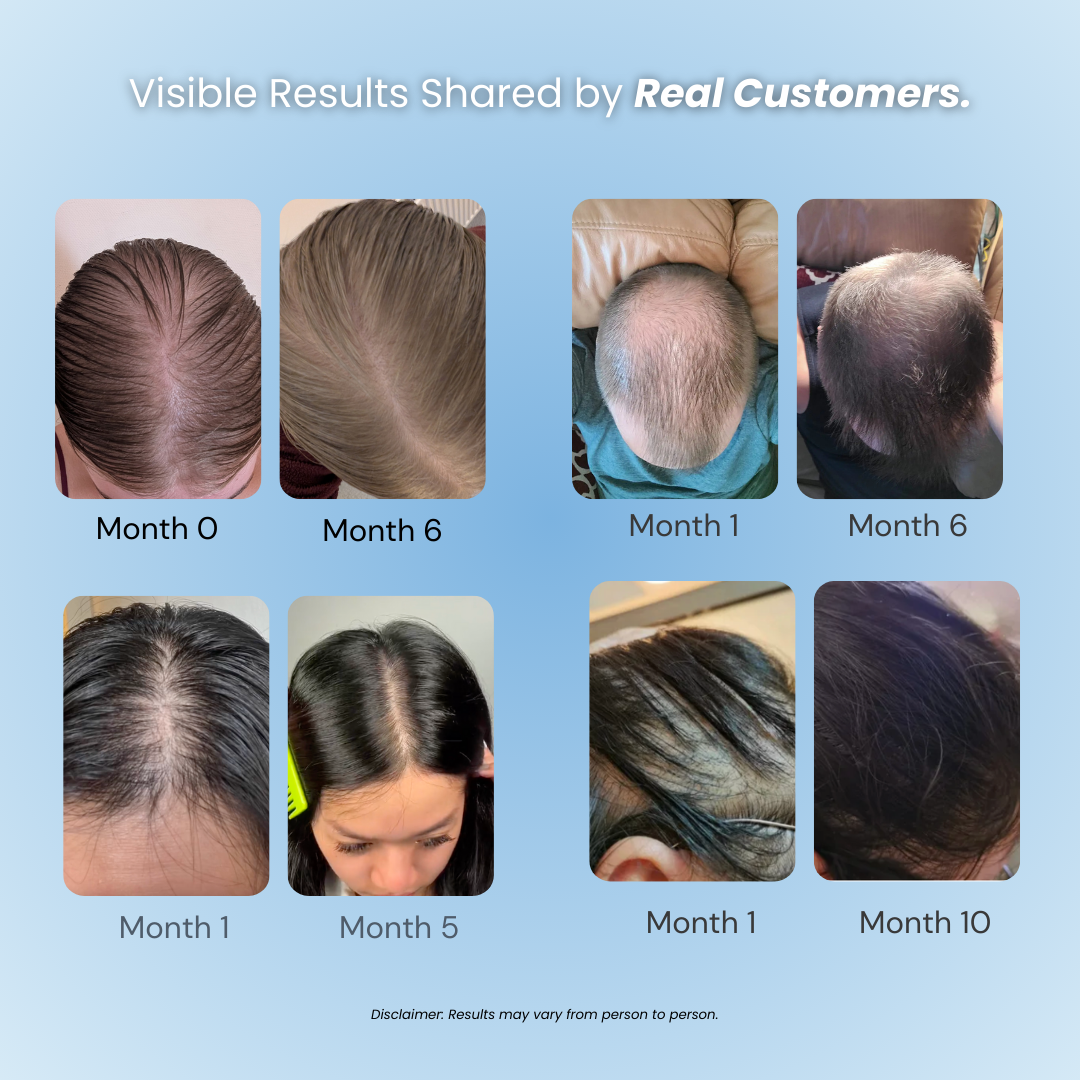 Hair Loss Prevention Kit