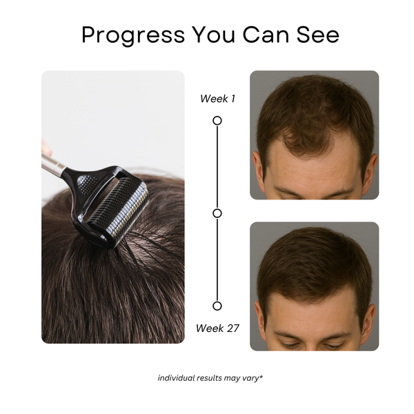 Scalp Roller 2.0 + Sanitizer