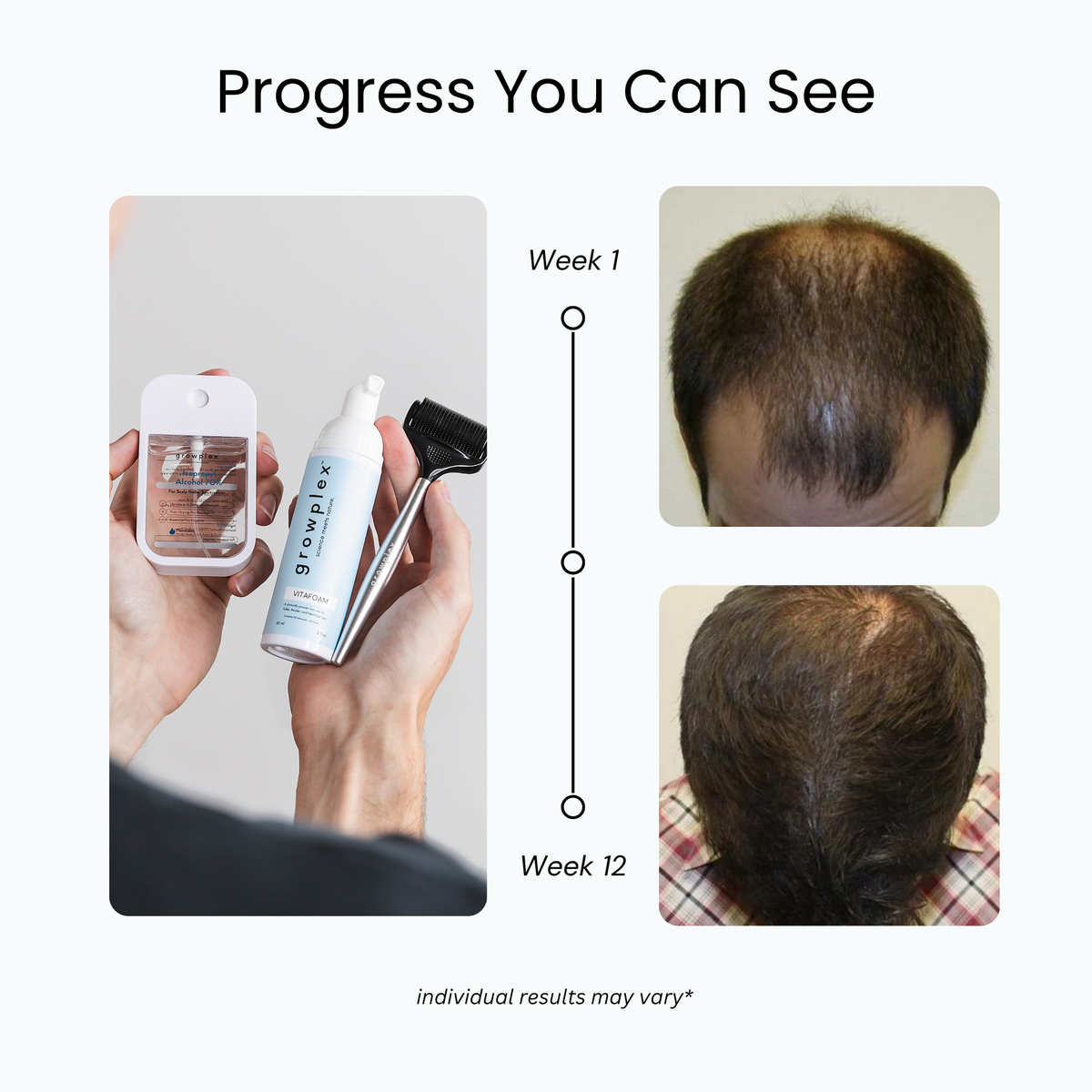 Growplex Shampoo The 3X Growth Kit™ – Growplex