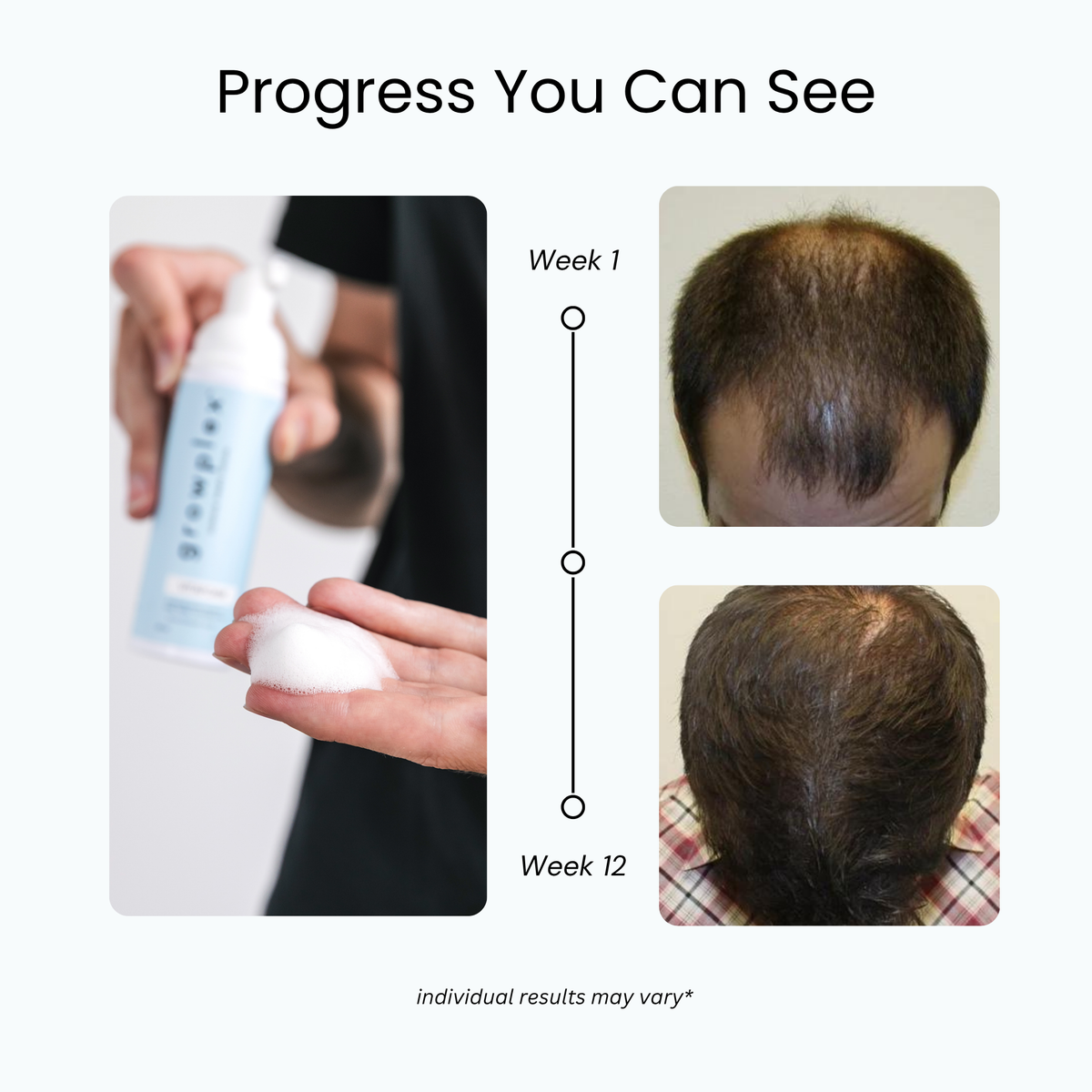 Full Regrowth Kit™