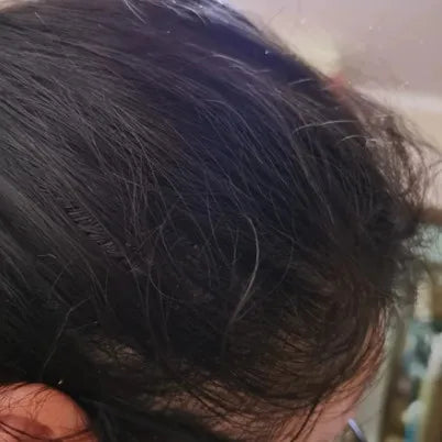 Donna N. after