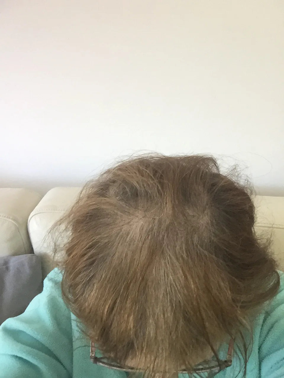 Janice B. after