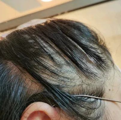 Donna N. before