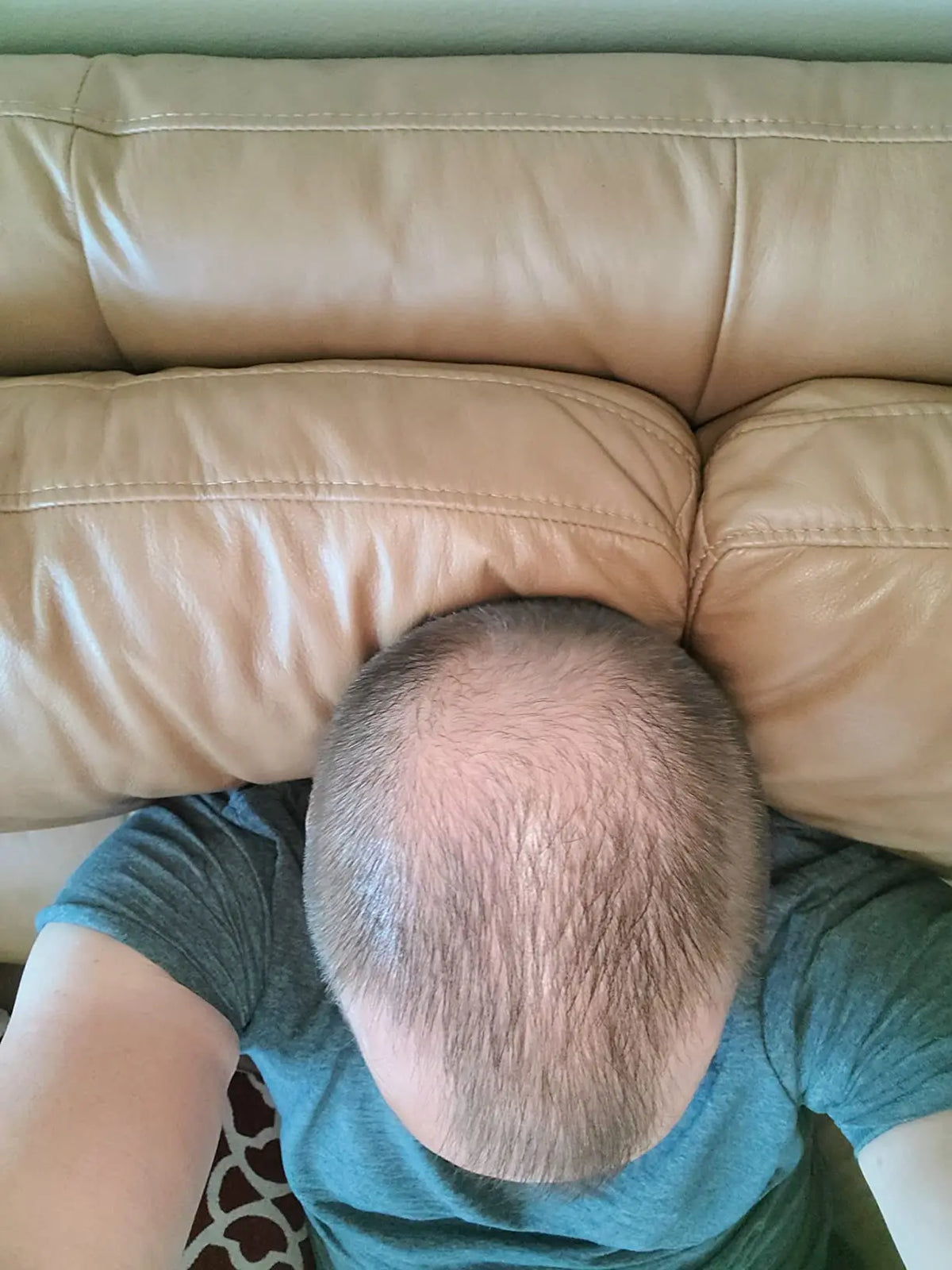 Before