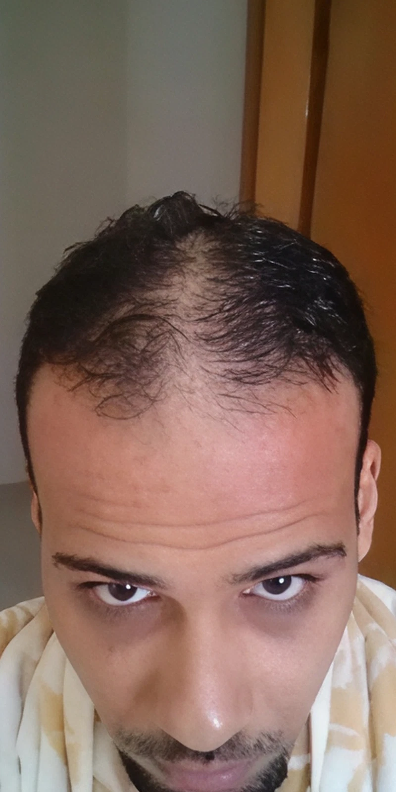 Before