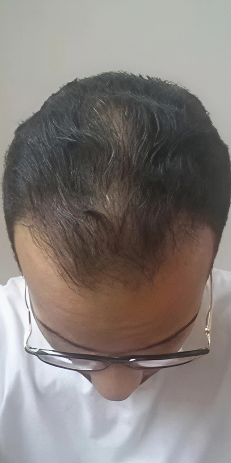 After