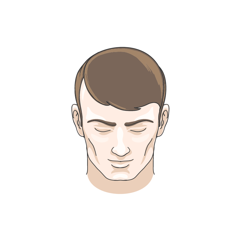 More Hair Fall