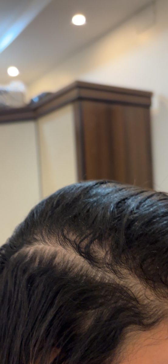 Rawan A., a Growplex customer, her start photo and new baby hairs along the part