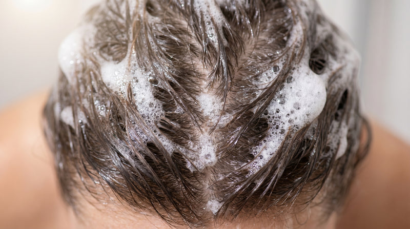 A scalp ready for more